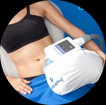 CoolSculpting